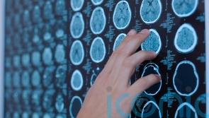 Poor heart health predicts premature brain ageing, study suggests