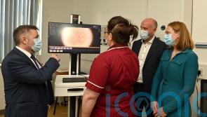 Mole-mapping service at Ulster Hospital first of its kind in Northern Ireland