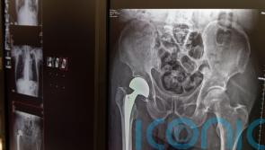 Hip fracture recovery ‘varies between hospitals’ – study