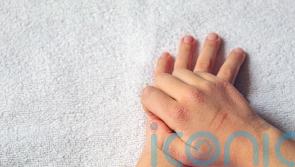 New drug therapy ‘highly effective’ for young children with severe eczema