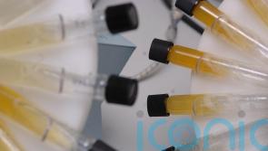 Not enough people offered kidney disease test, research finds