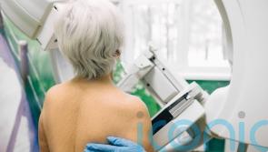 Cancer screening ‘must not get lost’ under other NHS pressures