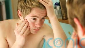 How to support a teenager who has acne