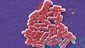 Class at Scottish primary school told to stay at home amid E.coli outbreak