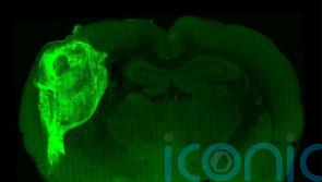 Human tissue transplanted into rats ‘could advance brain disorders research’