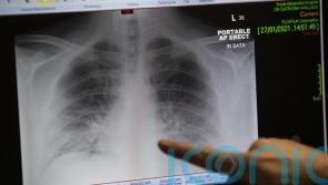 Community diagnostic centres ‘may struggle to live up to ministers’ promises’