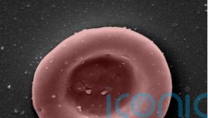‘Lab-grown red blood cells transfused in to person in a world first’