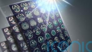 Breakthrough Alzheimer’s drug could be in UK use in a year but only for minority