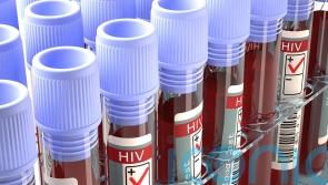 Pandemic ‘has slowed progress towards eliminating new cases of HIV in England’