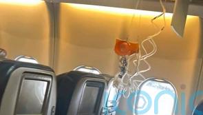 11 people seriously injured amid turbulence on Hawaii flight
