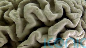 US approves Alzheimer’s drug that can slow disease’s progress