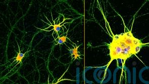 Lab grown nerve cells ‘holds promise for neurodegenerative disease’