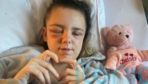 Girl thanks medics after life-saving surgery saw part of skull stored in stomach