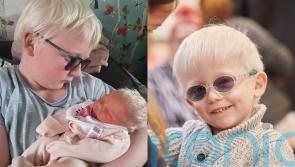 Couple ‘blessed’ to have three children with albinism bemoan ‘rude’ comments and say ‘never judge a book by its cover’
