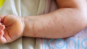 Children with eczema ‘should not be offered bath emollients on the NHS’