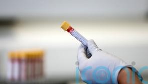 Bodies of people with mental illness ‘biologically older than their actual age’