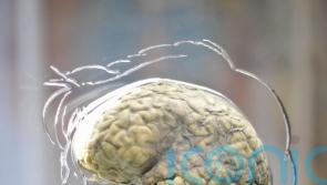 ‘45% of people with concussion show brain injury symptoms six months later’