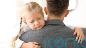 Can I go to work if my child has chickenpox?