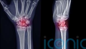 Up to one in three with rheumatoid arthritis ‘at risk of long-term opioid use’