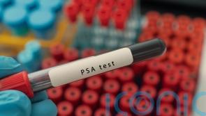 Call to ditch ‘test by request’ approach to prostate cancer care