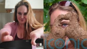 Mum with rare genetic disorder called ‘mutant’ for having two fingers and two toes teaches people how to cook like her