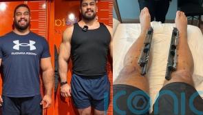 Dad of two spends &pound;86,000 lengthening his limbs to grow from 6ft to 6ft 7in so he feels &lsquo;on top of the world&rsquo;