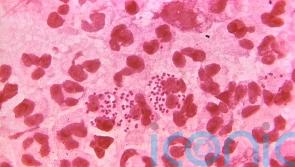 Sexually transmitted infections found in 13-year-olds as cases hit record high