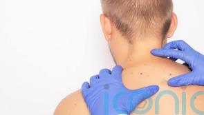 Smartphone camera lens technology to be used in skin cancer diagnoses