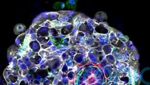 ‘Synthetic’ human embryos created without eggs or sperm