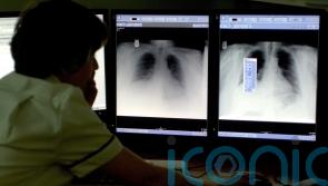 AI to be deployed more widely across the NHS as new funding announced