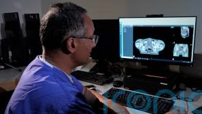AI could be used to treat more cancers after freeing up radiologists’ time