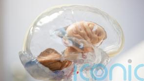 Genetic breakthrough could prevent MS progression, researchers say