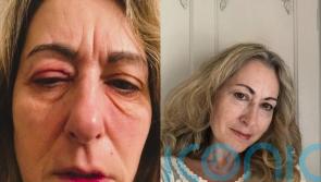 Mum who feared she was losing her sight when she woke up with her red swollen eyes ‘glued shut’ finds miracle cure