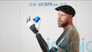 Above-the-elbow amputee ‘moves individual fingers in bionic limb in world first’