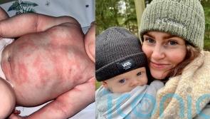 Mum who felt ‘helpless’ as her baby suffered sleepless nights with horrific rash praises ‘life-saver’ cream