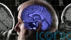 Why is this Alzheimer’s breakthrough so important?