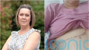 My children said their goodbyes: Mum’s remarkable recovery after third transplant of liver that was being ‘eaten away’