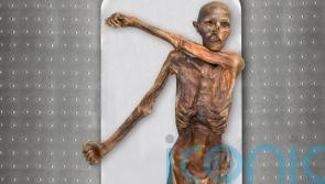 Iceman Otzi had dark skin and male pattern baldness, analysis reveals