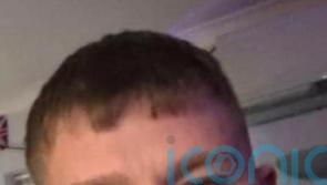 Seventh man arrested in gun murder probe as police search for car