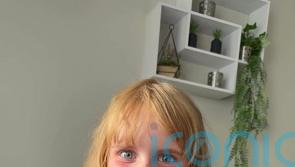Darcee, 5, is cover star of book explaining her skin condition to classmates