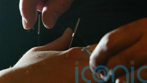 Acupuncture and craniosacral therapy ads banned over long Covid treatment claims