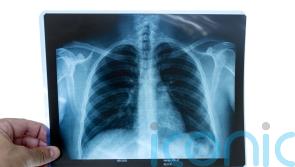 Radiographers to walk out across England in action over pay