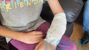 Man arrested after 11-year-old injured in attack by American bully XL dog