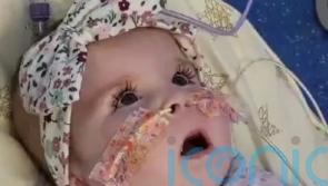 Father of critically ill baby at centre of treatment fight tells of ‘nightmare’