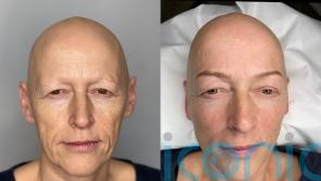 Mum who lost hair twice after chemotherapy and marriage breakdown says ‘life’s for living’ as she embraces 3D eyebrows