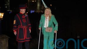 Penny Lancaster suffers knee injury while on tour with husband Sir Rod Stewart