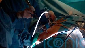 Major advance in transplants as monkey survives two years with pig kidney