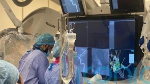 AI-driven software could revolutionise brain aneurysm treatment