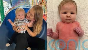 Mum whose baby suffered with eczema so bad it caused her to bleed found solution thanks to her 10,000 viewers on TikTok