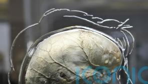 Non-invasive deep brain stimulation ‘could provide treatment for brain diseases’